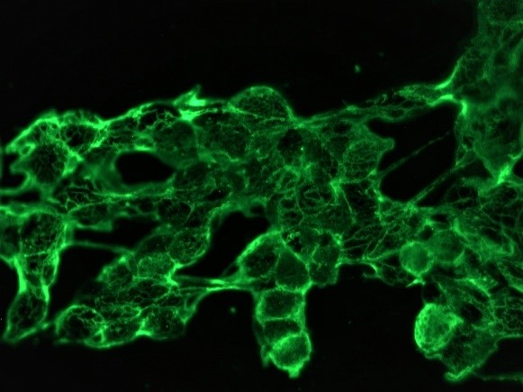 Figure 2. Indirect immunofluorescence staining of human neural cells (SH-SY-5Y) in tissue culture with 0566P (diluted 1:200), showing the specific staining pattern of NCAM/CD56 adhesion sites in between the individual cells.
